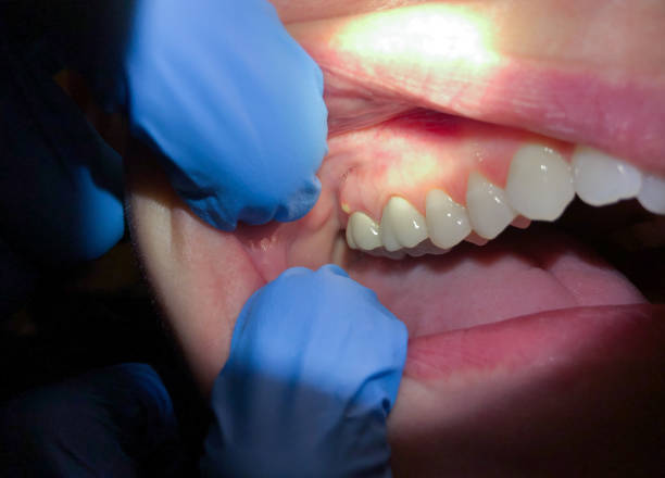 Best Walk-In Emergency Dental Services in Tuscumbia, AL