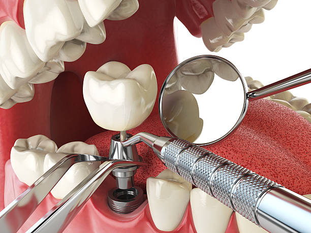 Best Emergency Root Canal Therapy in Tuscumbia, AL